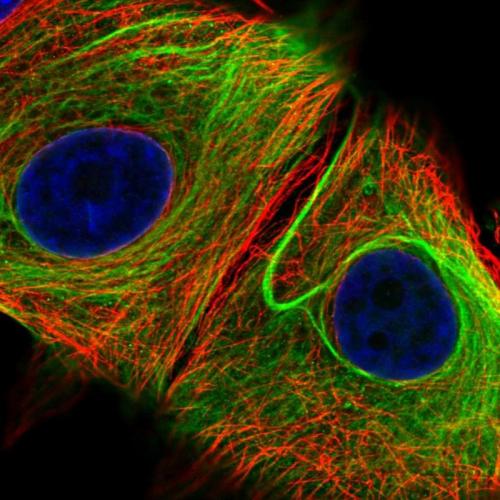 Immunofluorescent staining of human cell