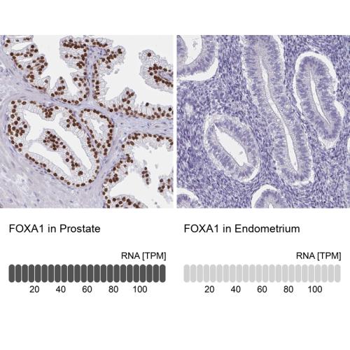 Immunohistochemistry analysis in human p