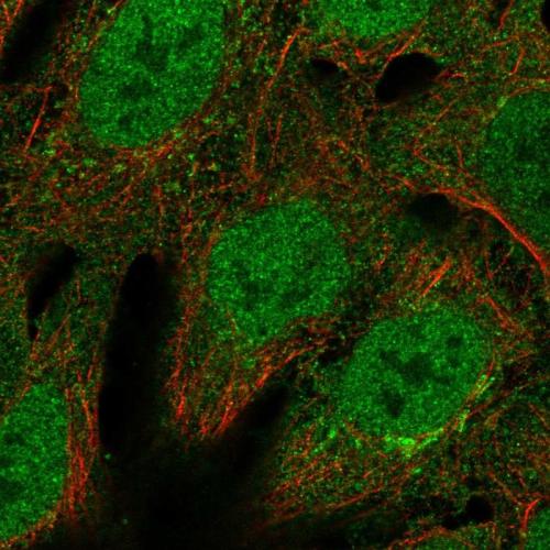 Immunofluorescent staining of human cell