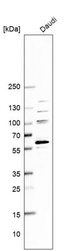 Western blot analysis in human cell line