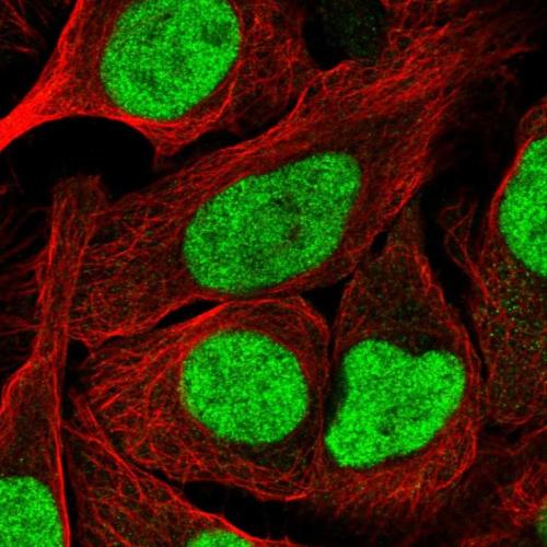 Immunofluorescent staining of human cell