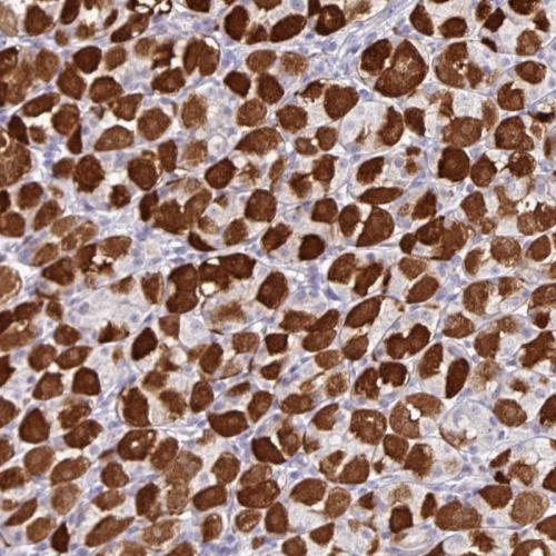 Immunohistochemical staining of human st