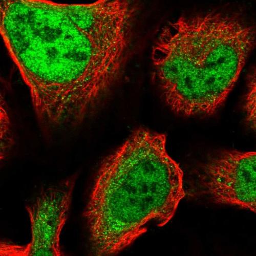 Immunofluorescent staining of human cell