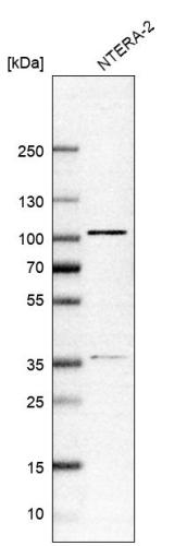 Western blot analysis in human cell line