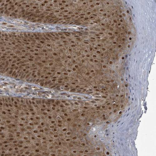 Immunohistochemical staining of human sk