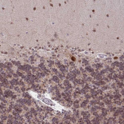 Immunohistochemical staining of human ce