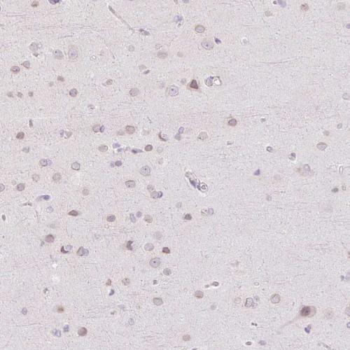 Immunohistochemical staining of human ce