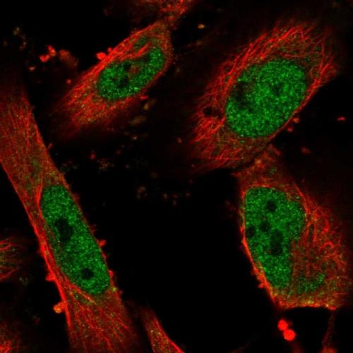 Immunofluorescent staining of human cell