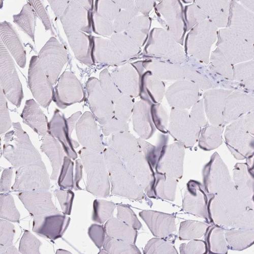 Immunohistochemical staining of human sk