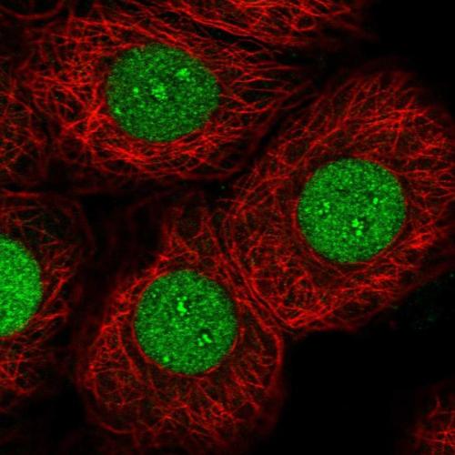 Immunofluorescent staining of human cell
