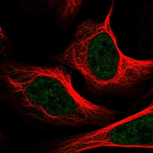 Immunofluorescent staining of human cell