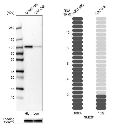 Western blot analysis in human cell line