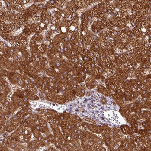 Immunohistochemical staining of human li