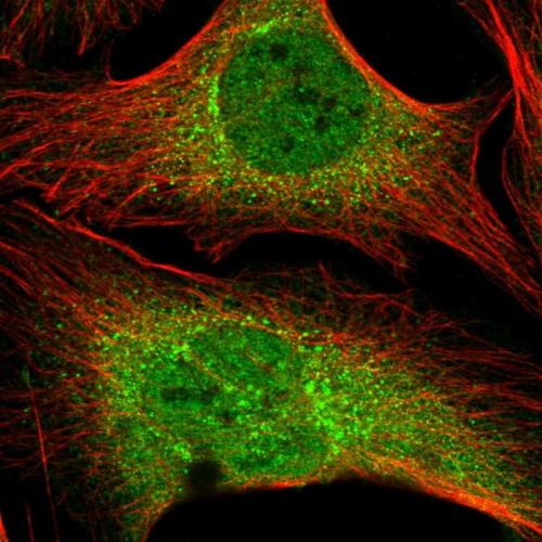 Immunofluorescent staining of human cell