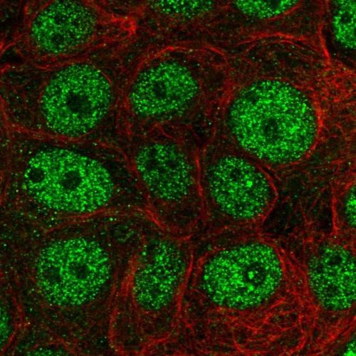 Immunofluorescent staining of human cell