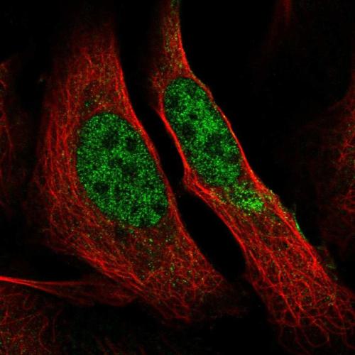 Immunofluorescent staining of human cell