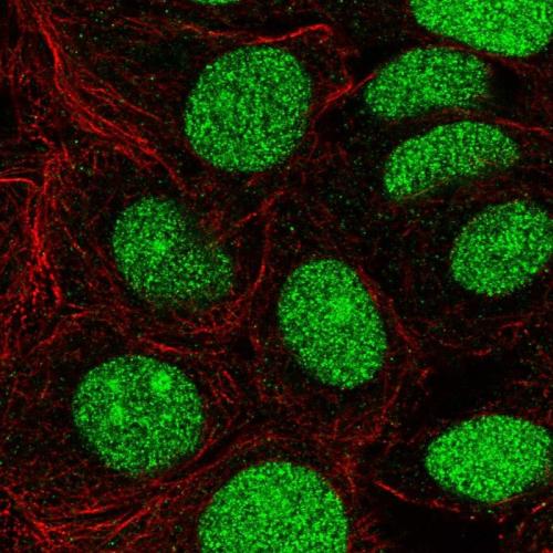 Immunofluorescent staining of human cell
