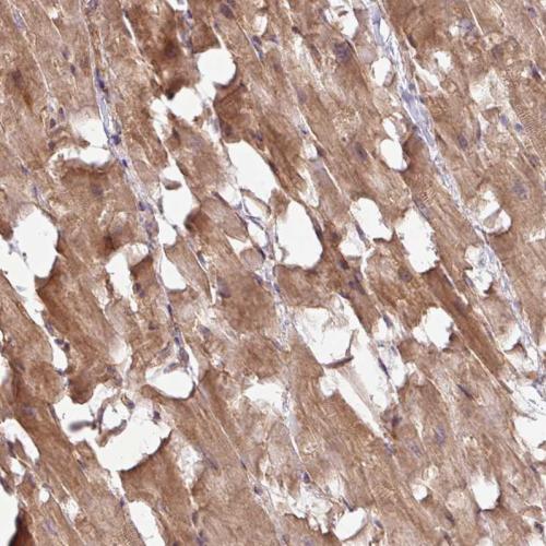Immunohistochemical staining of human he