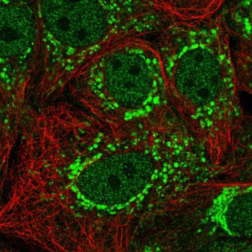 Immunofluorescent staining of human cell