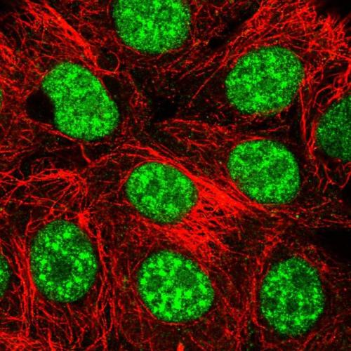 Immunofluorescent staining of human cell