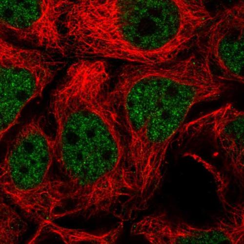 Immunofluorescent staining of human cell