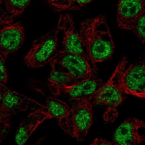 Immunofluorescent staining of human cell