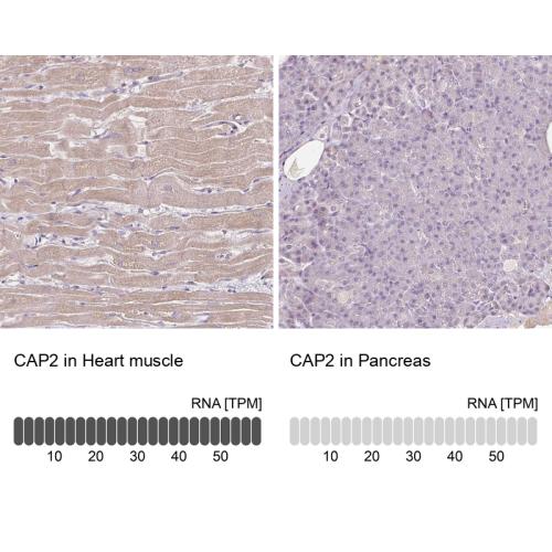 Immunohistochemistry analysis in human c