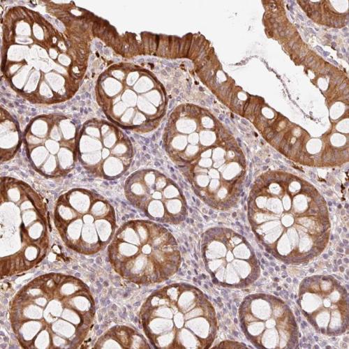 Immunohistochemical staining of human co