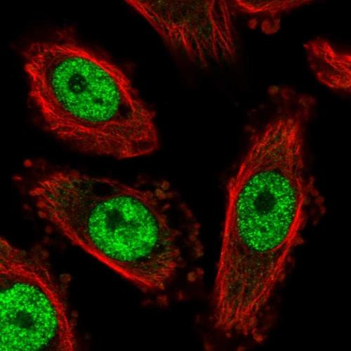 Immunofluorescent staining of human cell