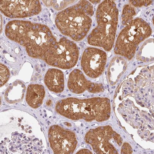 Immunohistochemical staining of human ki