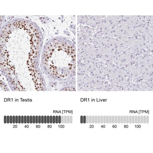 Immunohistochemistry analysis in human t