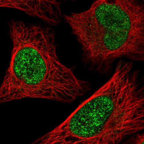 Immunofluorescent staining of human cell