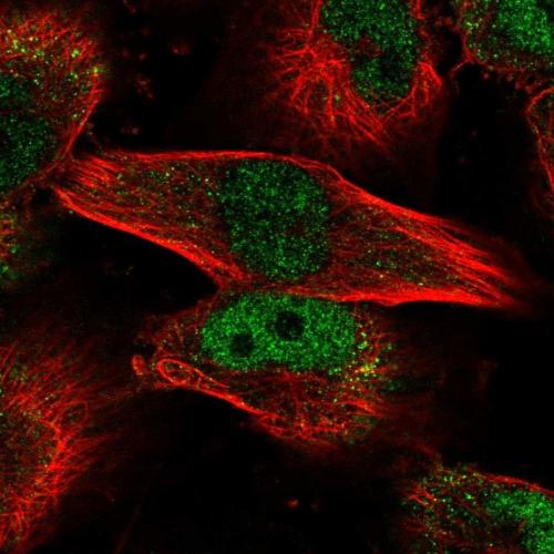 Immunofluorescent staining of human cell