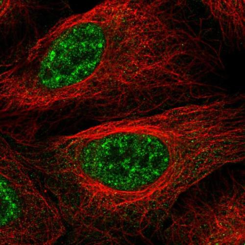 Immunofluorescent staining of human cell