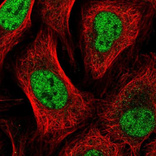 Immunofluorescent staining of human cell