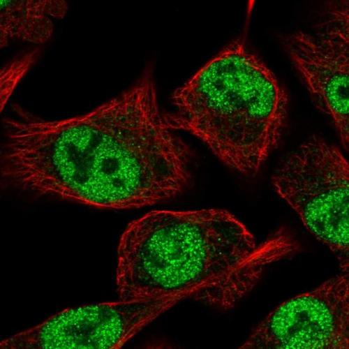 Immunofluorescent staining of human cell