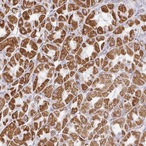 Immunohistochemical staining of human st