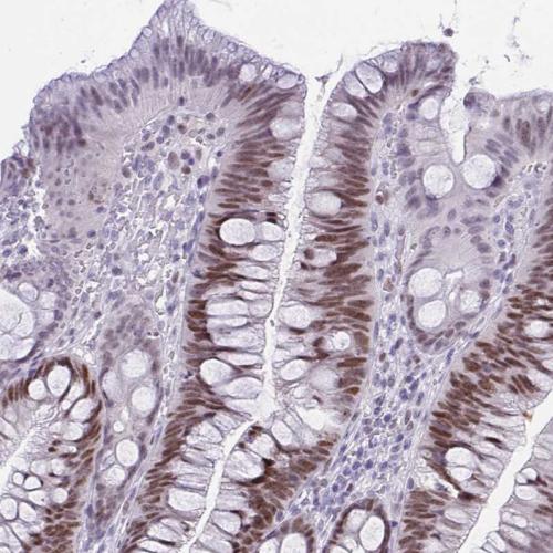 Immunohistochemical staining of human co