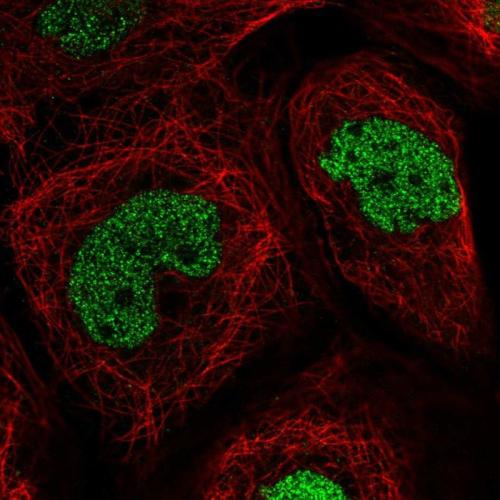 Immunofluorescent staining of human cell