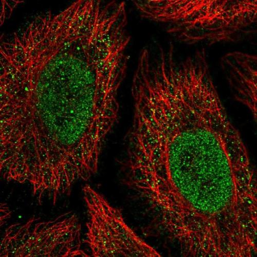 Immunofluorescent staining of human cell