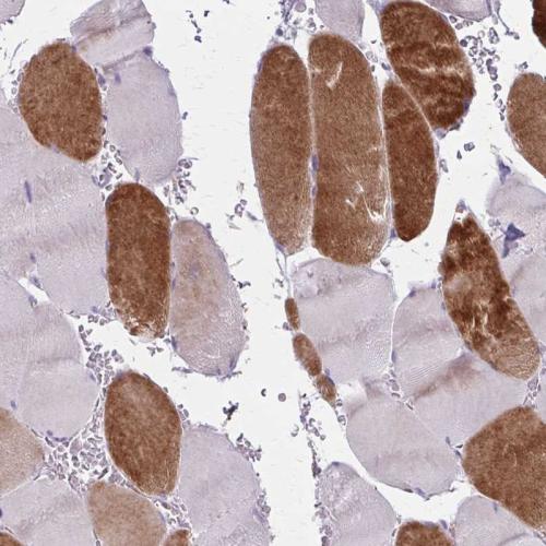 Immunohistochemical staining of human sk