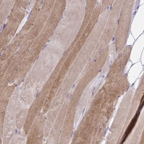 Immunohistochemical staining of human sk