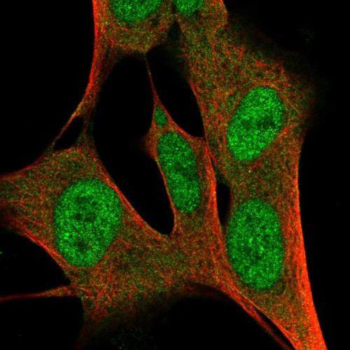 Immunofluorescent staining of human cell
