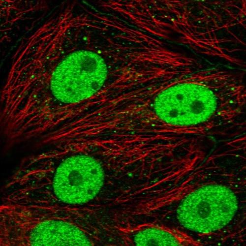 Immunofluorescent staining of human cell