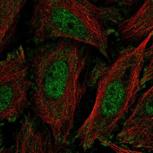 Immunofluorescent staining of human cell
