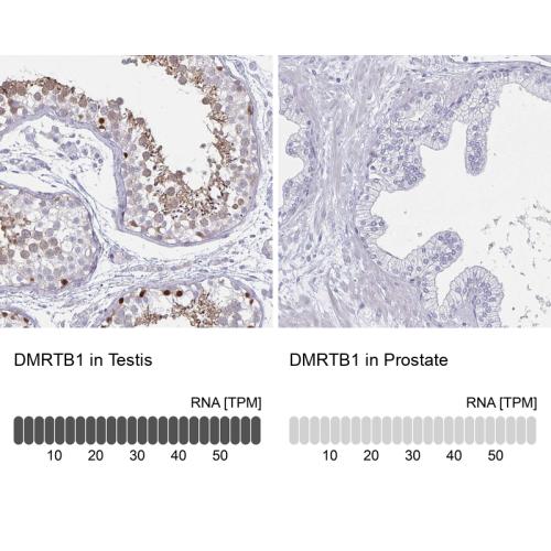 Immunohistochemistry analysis in human t
