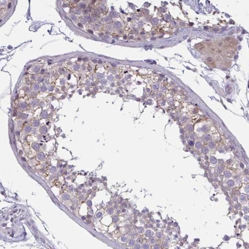Immunohistochemical staining of human te