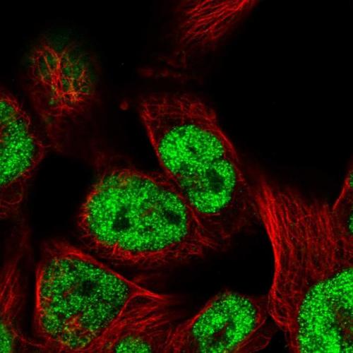 Immunofluorescent staining of human cell