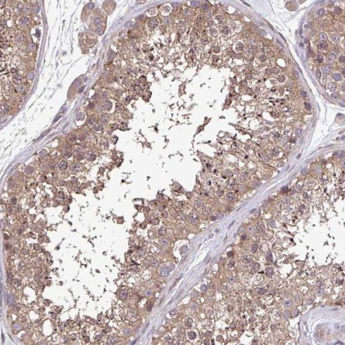 Immunohistochemical staining of human te