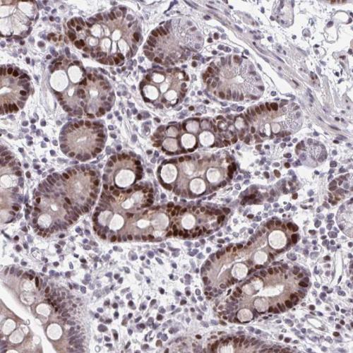 Immunohistochemical staining of human du